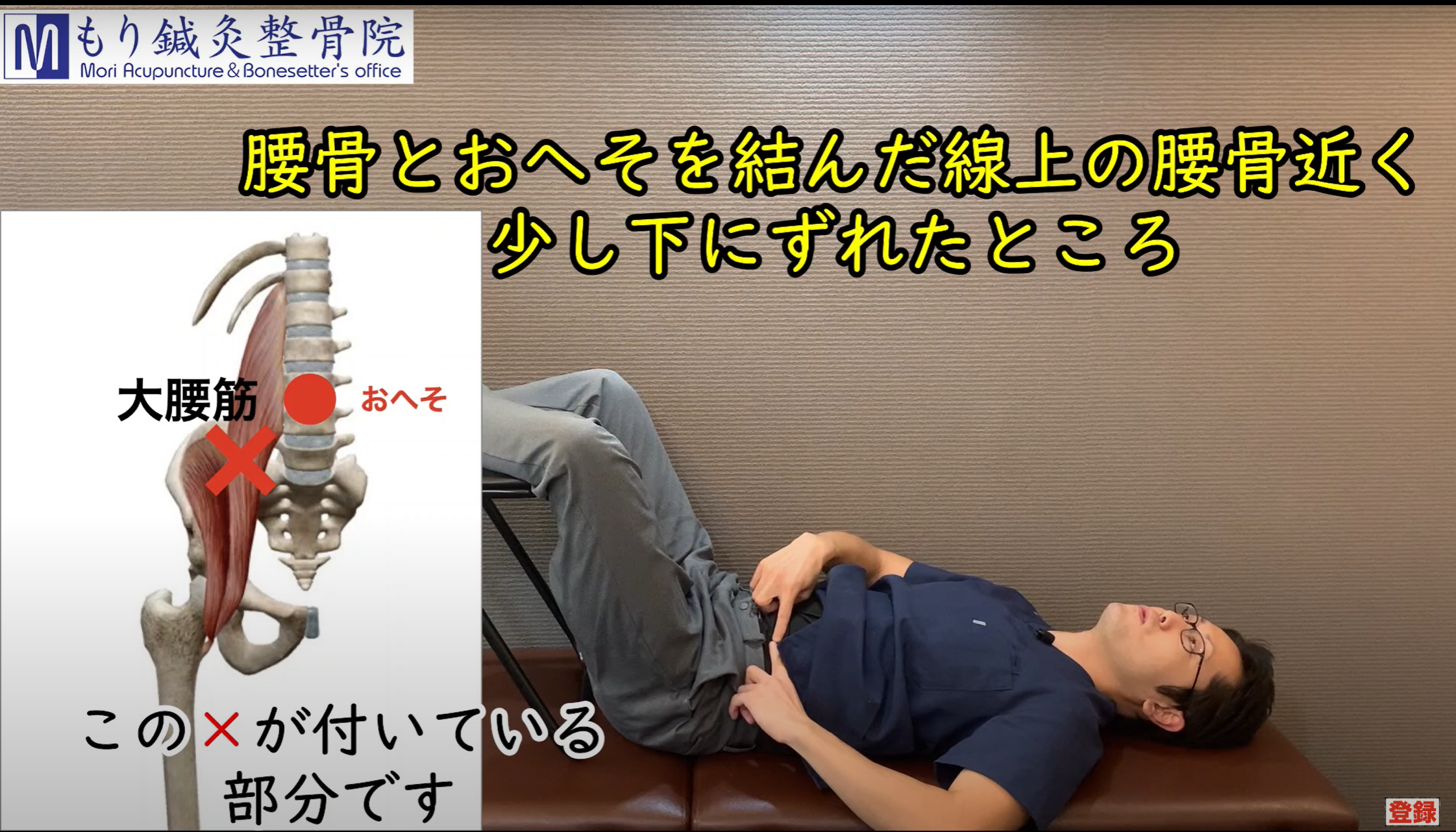 椎間板 ヘルニア を 早く 治す 方法