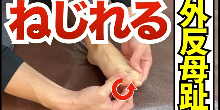 足の親指がねじれる「外反母趾」その原因と改善方法