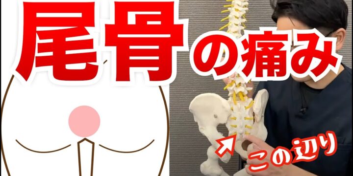 尾骨の痛み原因と改善方法