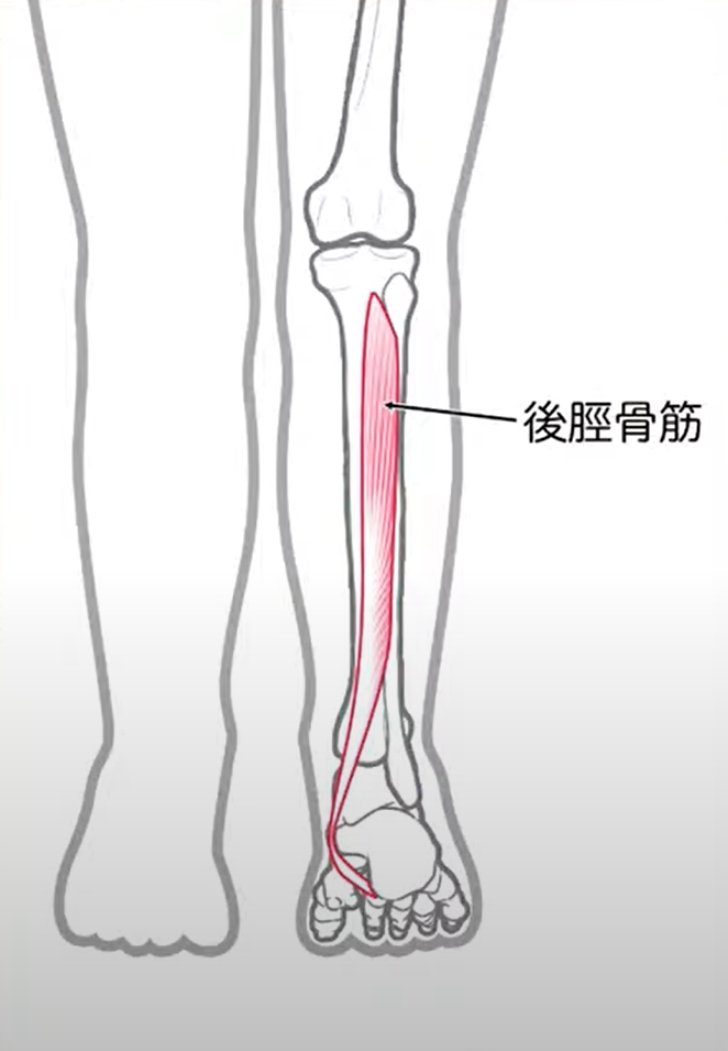 内くるぶしの痛み！後脛骨筋不全の原因と簡単テーピング法