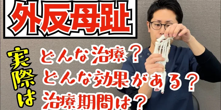【徹底解説】こうするとよくなる！当院の外反母趾の治療について