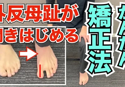 外反母趾を自分で治すかんたん矯正法