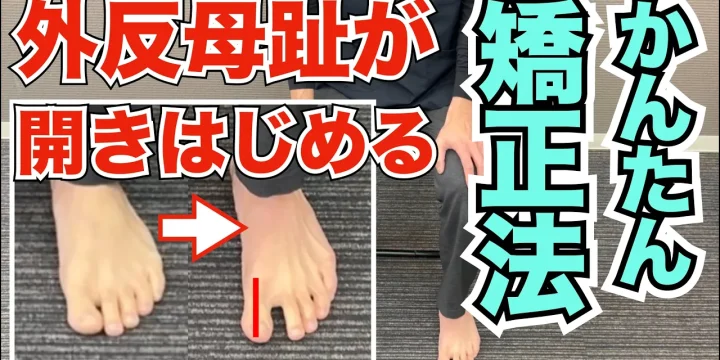 外反母趾を自分で治すかんたん矯正法