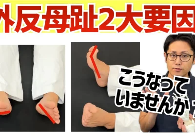 あなたは大丈夫？外反母趾が悪化しやすい2つの要素とは