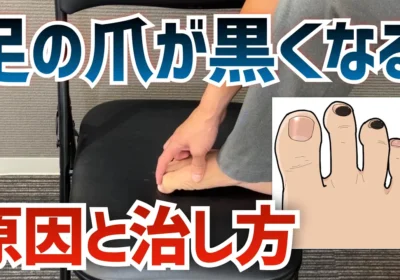足の爪が黒い黒爪の2つの原因とは？前滑りと浮き指が関係します