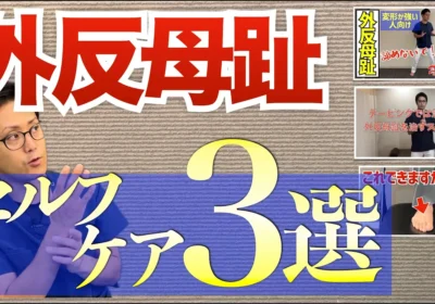 外反母趾のセルフケアおすすめ3選 足首のストレッチが最重要な理由