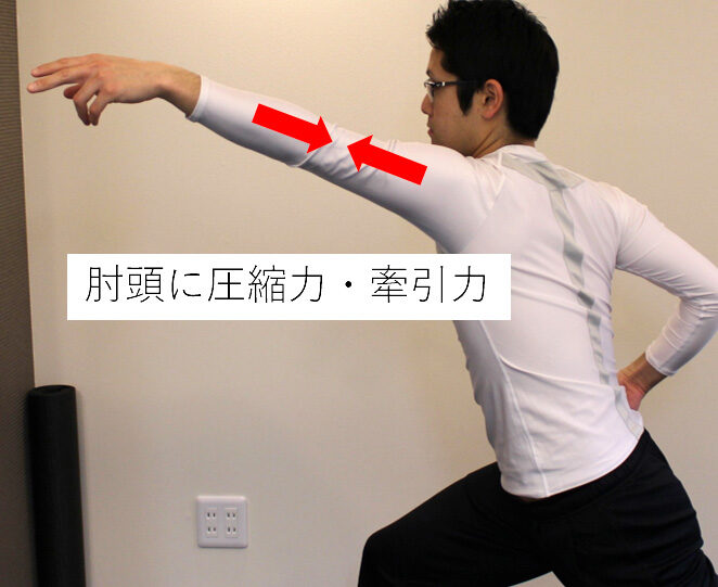 腕を伸ばした姿勢を横から撮り、肘頭にかかる圧縮力と牽引力の向きを矢印で示した写真