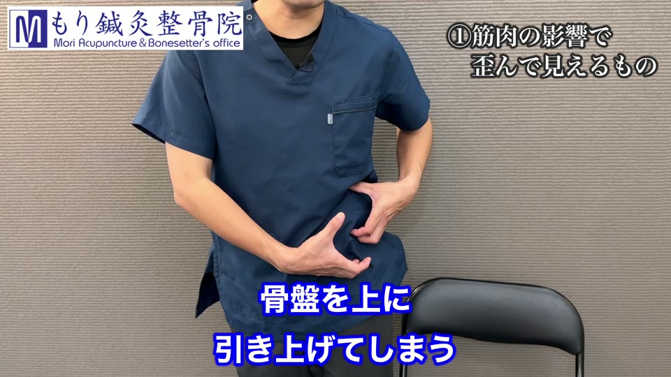 筋肉の影響で骨盤が引き上げられて見える様子